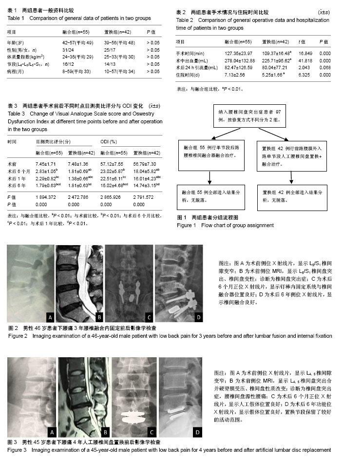 腰椎治疗前沿资讯